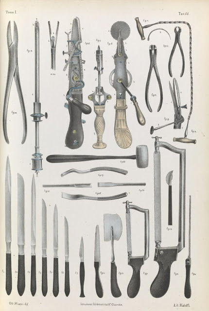 Πώς γίνονταν οι χειρουργικές επεμβάσεις το 1840 - ΣΥΓΚΛΟΝΙΣΤΙΚΕΣ εικόνες από χειρουργεία ΧΩΡΙΣ ΑΝΑΙΣΘΗΤΙΚΟ... [photos] - Φωτογραφία 6
