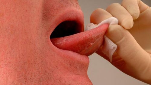 ΠΡΟΣΟΧΗ! Καρκίνος του στόματος: Αυτά είναι τα αθόρυβα συμπτώματα - Φωτογραφία 1