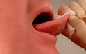 ΠΡΟΣΟΧΗ! Καρκίνος του στόματος: Αυτά είναι τα αθόρυβα συμπτώματα