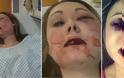 ΕΞΟΡΓΙΣΤΙΚΕΣ εικόνες: Της έσπασε το σαγόνι και τρία δόντια επειδή δεν ήθελε να κάνουν... [photos]