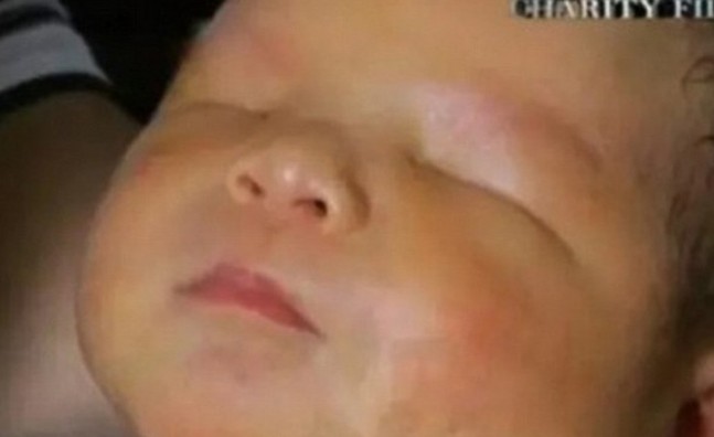 Μωρό γεννήθηκε χωρίς μάτια! [photos + video] - Φωτογραφία 1