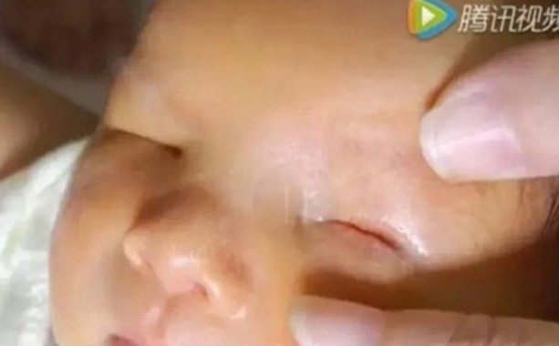 Μωρό γεννήθηκε χωρίς μάτια! [photos + video] - Φωτογραφία 2