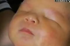 Μωρό γεννήθηκε χωρίς μάτια! [photos + video]