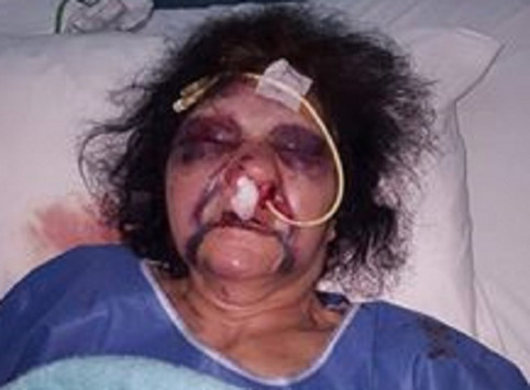 Πέθανε η Κατερίνα Αθανασάκη - Τα φονικά χτυπήματα που σόκαραν τους χρήστες του facebook! - Φωτογραφία 1