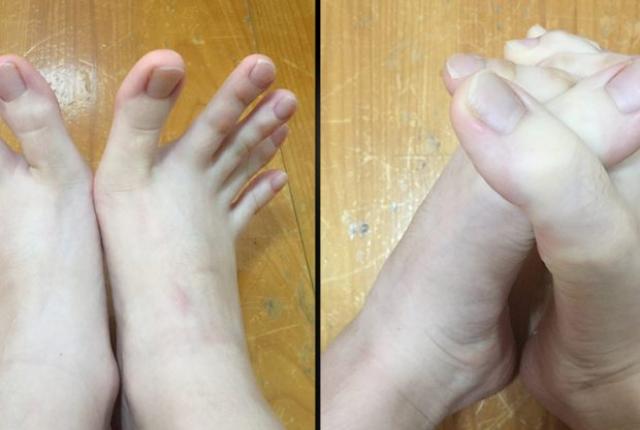 Τα δάχτυλα των ποδιών αυτής της γυναίκας έχουν μπερδέψει και τρελάνει το διαδίκτυο [photos] - Φωτογραφία 1