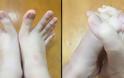 Τα δάχτυλα των ποδιών αυτής της γυναίκας έχουν μπερδέψει και τρελάνει το διαδίκτυο [photos]