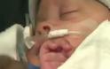 Συγκλονιστικό βίντεο: Μωρό γεννήθηκε στον αμνιακό του σάκο! [photos]