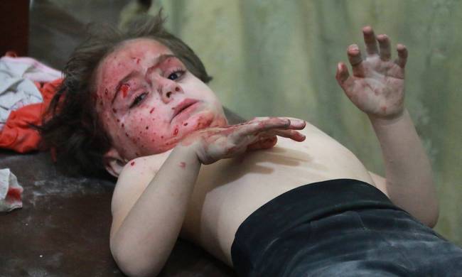 ΠΡΟΣΟΧΗ! Εικόνες ΦΡΙΚΗΣ στη Συρία: Πρελούδιο θανάτου για χιλιάδες αθώα παιδιά - Φωτογραφία 1