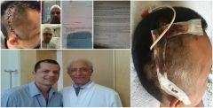 SOS: O Παναγιώτης Αποστόλου από το Μεσοπόταμο Πρέβεζας διαγνώστηκε με Καρκίνο στο κεφάλι και ζητάει την στήριξη όλων μας! - Φωτογραφία 1