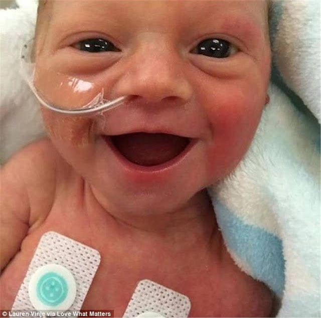 Μοναδική στιγμή: Πρόωρο μωρό μόλις 1.700 γραμμαρίων, χαμογελάει στην αγκαλιά της μαμάς του [photos] - Φωτογραφία 2