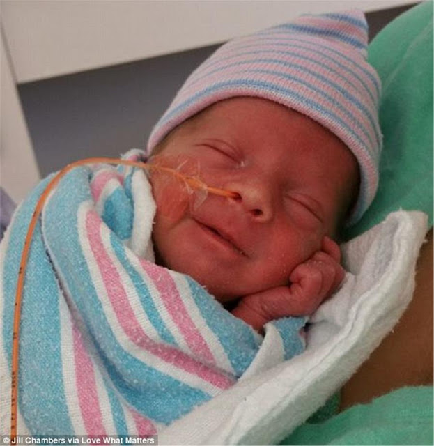 Μοναδική στιγμή: Πρόωρο μωρό μόλις 1.700 γραμμαρίων, χαμογελάει στην αγκαλιά της μαμάς του [photos] - Φωτογραφία 3