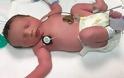 Ιατρικό θαύμα: Το μωρό που γεννήθηκε δύο φορές [photos] - Φωτογραφία 1