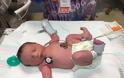 Ιατρικό θαύμα: Το μωρό που γεννήθηκε δύο φορές [photos] - Φωτογραφία 5