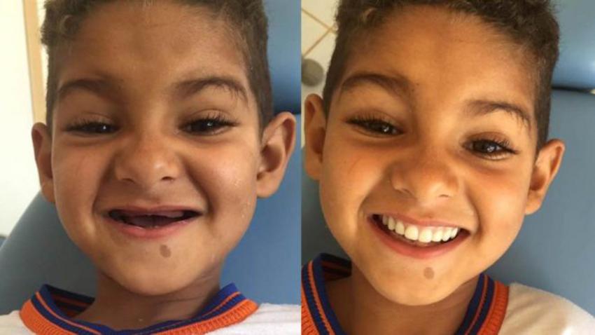 Βραζιλία: 6χρονος απέκτησε και πάλι το χαμόγελο που τόσο λαχταρούσε - Φωτογραφία 1
