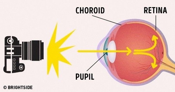 Ο πραγματικός λόγος που τα μάτια μας βγαίνουν κόκκινα στις φωτογραφίες - Φωτογραφία 2
