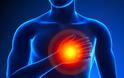 Καρδιακή Προσβολή: 10 συμπτώματα που εμφανίζονται 30 μέρες πριν