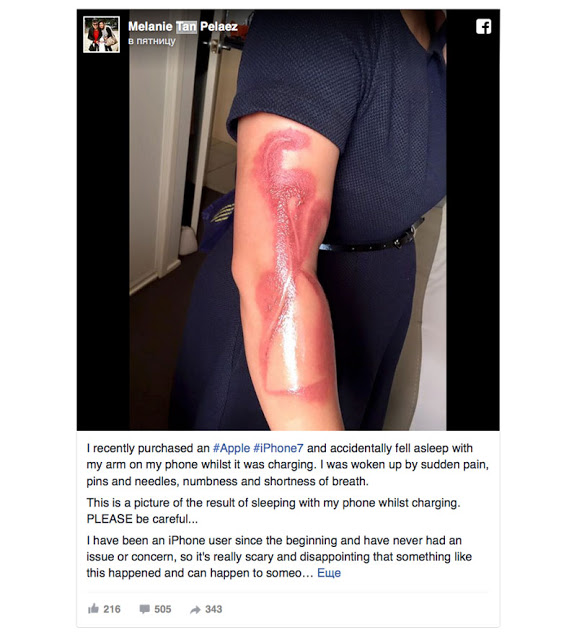 Μια γυναίκα στην Αυστραλία ζητά αποζημίωση από την Apple για εγκαύματα από το iPhone 7 - Φωτογραφία 5
