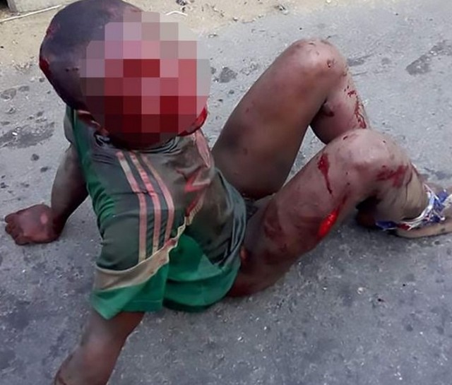 Έκαψαν ζωντανό μικρό αγόρι στο δρρόμο, το γιατί θα σας σοκάρει! [photos] - Φωτογραφία 3