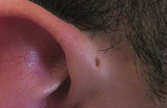 Εσύ ξέρεις τι σημαίνει αυτή η τρύπα στα αυτιά μερικών ανθρώπων; Μόλις μάθετε θα ανατριχιάσετε... - Φωτογραφία 1