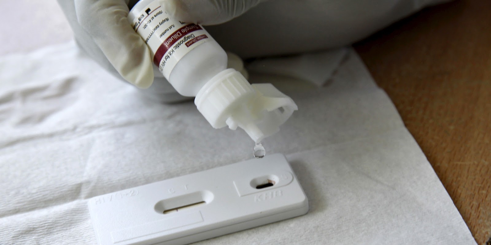 Ξεκινά η μεγαλύτερη δοκιμή ενός νέου εμβολίου κατά του AIDS με στόχο την ολοκληρωτική θεραπεία - Φωτογραφία 1
