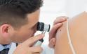 Καρκίνος του δέρματος: Πρωτοποριακή μέθοδος διάγνωσης με την σφραγίδα δύο Ελληνίδων επιστημόνων