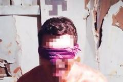 Σάλος με σοκαριστικές τελετές μύησης σε αδελφότητα αμερικανικού πανεπιστημίου [ΣΚΛΗΡΕΣ ΕΙΚΟΝΕΣ]