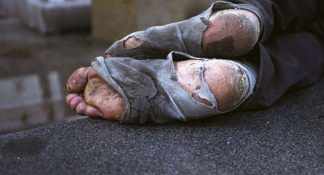 ΑΔΙΑΝΟΗΤΟ:Παιδιά 12 ετών έκαψαν ζωντανό άστεγο! - Φωτογραφία 1
