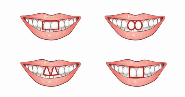 Τα μπροστινά σας δόντια είναι ΈΤΣΙ; Αυτό σημαίνει ότι... - Φωτογραφία 1