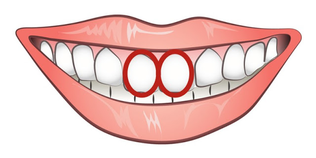 Τα μπροστινά σας δόντια είναι ΈΤΣΙ; Αυτό σημαίνει ότι... - Φωτογραφία 3