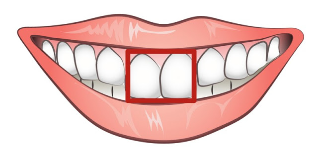 Τα μπροστινά σας δόντια είναι ΈΤΣΙ; Αυτό σημαίνει ότι... - Φωτογραφία 5