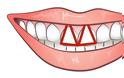 Τα μπροστινά σας δόντια είναι ΈΤΣΙ; Αυτό σημαίνει ότι... - Φωτογραφία 4