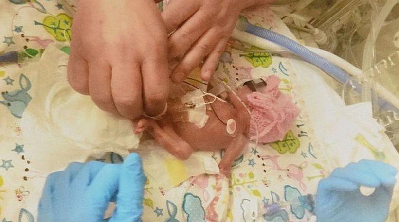 Το θαύμα της ζωής: Μωρό γεννήθηκε 623 γραμμάρια, έκανε 11 λεπτά να αναπνεύσει και επέζησε! - Φωτογραφία 1