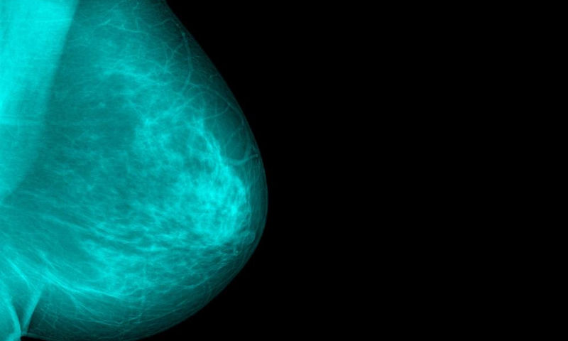 Καρκίνος του μαστού: Ο ρόλος των αποβολών - Φωτογραφία 1