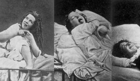 Οι πιο ΠΑΡΑΞΕΝΟΙ τρόποι αντιμετώπισης των πιο συχνών γυναικείων παθήσεων τον 19ο Αιώνα θα σας... σοκάρουν! - Φωτογραφία 1