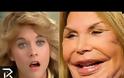 Θα τρίβετε τα όμορφα... ματάκια σας! Celebrities που κατέληξαν αγνώριστοι από τις πλαστικές