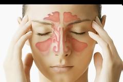 Χρόνια ιγμορίτιδα: Αίτια, συμπτώματα και τρόποι αντιμετώπισης