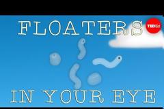 Τι είναι αυτά τα σημάδια που καμιά φορά… αιωρούνται στα μάτια σας [video]