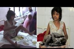 Άναρθρες κραυγές βγάζει αυτό το  κορίτσι  «Μόγλης» που βρέθηκε σε ζούγκλα της Ινδίας - Η μικρή περπατά στα τέσσερα, έχει εξάρσεις θυμού και βίας