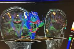 Επιβλαβής ο λίγος αλλά και ο πολύς ύπνος