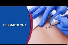 Πώς δημιουργούνται τα μαύρα στίγματα και πώς θα απαλλαγείτε από αυτά;