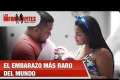 Εξαιρετικά σπάνια περίπτωση: Μωρό είχε στην κοιλιά του το δίδυμο αδελφάκι του