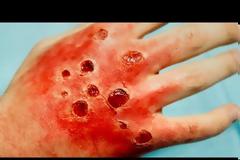 10 ασθένειες που μπορούν να σε σκοτώσουν σε μια μέρα! (ΒΙΝΤΕΟ)!!