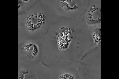 Όλα όλα μπορεί να «κρύβουν» ο βήχας και ο θωρακικός πόνος