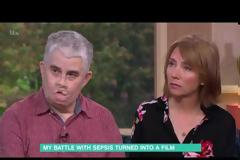 Από μία επίσκεψη στον οδοντίατρο βρέθηκε με ακρωτηριασμένα πόδια και χέρια