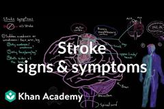 Εγκεφαλικό: Αυτά είναι τα συμπτώματα – Βασικός οδηγός για όλους (video)