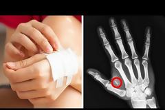 ΥΠΟΧΡΕΩΤΙΚΗ ΕΓΚΑΤΑΣΤΑΣΗ ΤΣΙΠ ΚΑΤΩ ΑΠΟ ΤΟ ΔΕΡΜΑ ΣΤΟ ΜΕΛΛΟΝ;(Βίντεο)