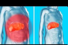 Σημάδια ότι το συκώτι σας είναι γεμάτο τοξίνες (Video)