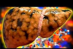 Τι θα συμβεί στο σώμα σου αν αρχίσεις να πίνεις νερό με λεμόνι κάθε μέρα;-ΒΙΝΤΕΟ,ΦΩΤΟ