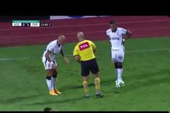 Διαιτητής μάζεψε τα...δόντια παίκτη από το χορτάρι!