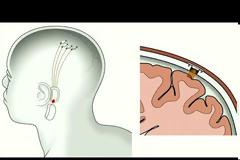 Κρυογονική – Άνθρωποι αναζητούν την αθανασία παγώνοντας τον εγκέφαλο ή το σώμα τους